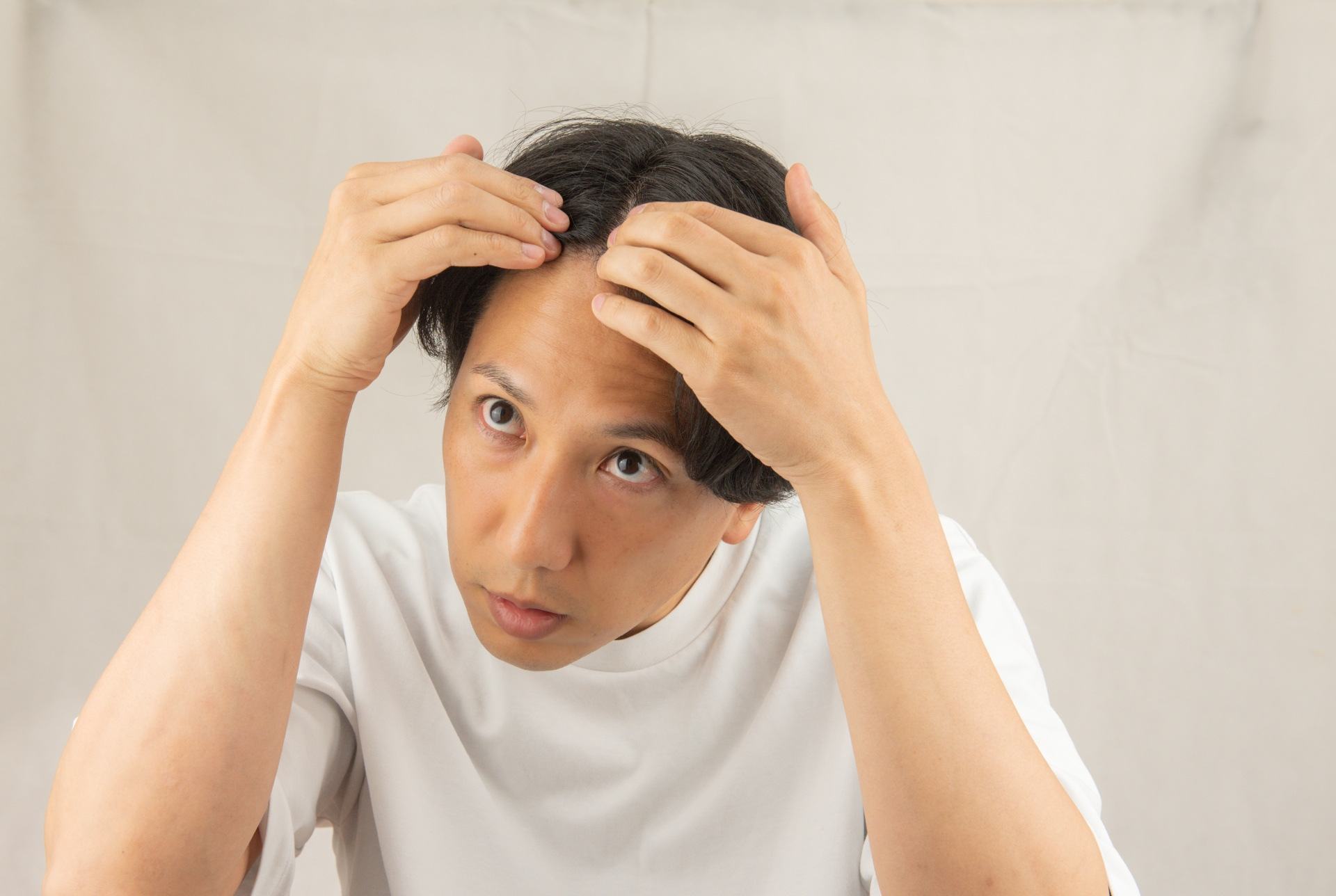 20代で薄毛になる原因と今すぐできる7つの対策【若ハゲは改善できる】